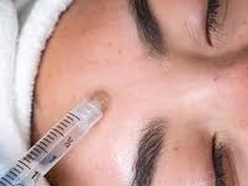 Exosome stem cell facial