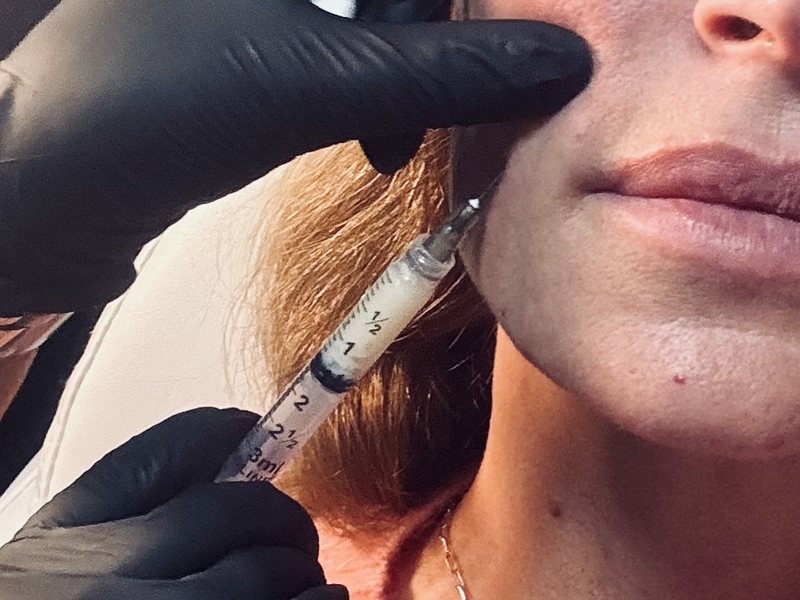 PRF filler