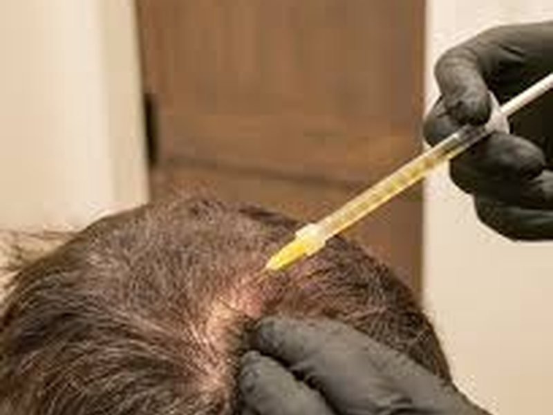 Hair restoration